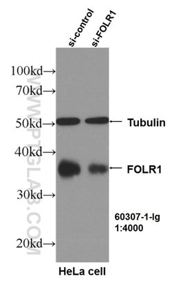 FOLR1 Mouse anti-Human, Clone: 2B4B7, Proteintech 150 &mu;L | Buy Online | Proteintech Group Inc | Fisher Scientific