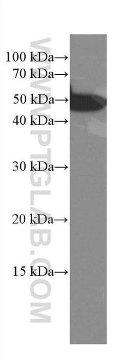 CREST Mouse anti-Human, Mouse, Rat, Clone: 3D5D10, Proteintech 20 &mu;L;