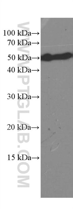 CREST Mouse anti-Human, Mouse, Rat, Clone: 3D5D10, Proteintech 20 &mu;L;