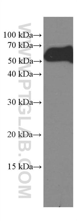 CREST Mouse anti-Human, Mouse, Rat, Clone: 3D5D10, Proteintech 20 &mu;L;