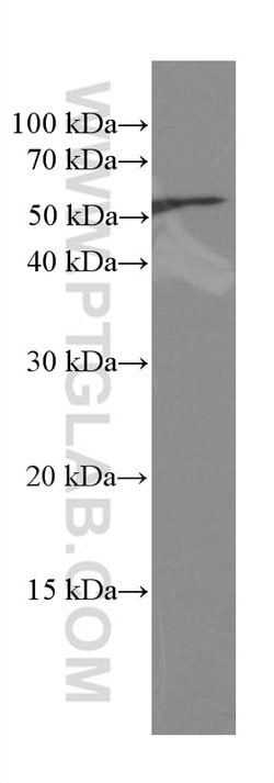 CREST Mouse anti-Human, Mouse, Rat, Clone: 3D5D10, Proteintech 20 &mu;L;