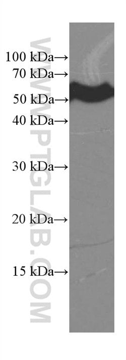 CREST Mouse anti-Human, Mouse, Rat, Clone: 3D5D10, Proteintech 20 &mu;L;