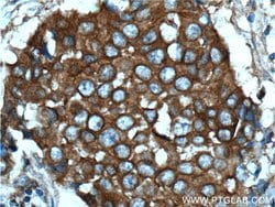 c-SRC Mouse anti-Hamster, Human, Mouse, Clone: 5E10C4, Proteintech:Antibodies:Primary