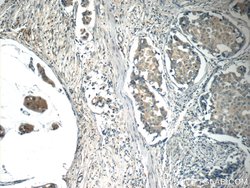 c-SRC Mouse anti-Hamster, Human, Mouse, Clone: 5E10C4, Proteintech:Antibodies:Primary