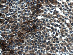 Cytokeratin 14 Mouse anti-Human, Mouse, Clone: 2G1E2, Proteintech 20 &mu;L | Buy Online | Proteintech | Fisher Scientific