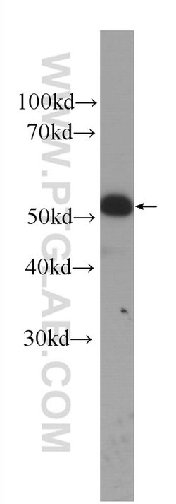 Cytokeratin 14 Mouse anti-Human, Mouse, Clone: 2G1E2, Proteintech 20 &mu;L | Buy Online | Proteintech | Fisher Scientific