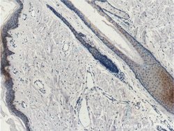 Cytokeratin 14 Mouse anti-Human, Mouse, Clone: 2G1E2, Proteintech 20 &mu;L | Buy Online | Proteintech | Fisher Scientific