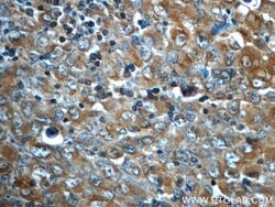 ALK/CD246 Mouse anti-Human, Clone: 7G9E3, Proteintech 150 &mu;L; Unconjugated:Antibodies,