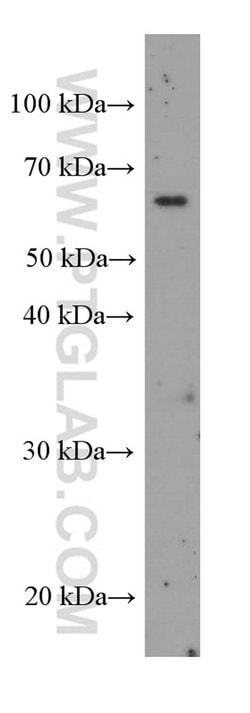 Bestrophin-1 Mouse anti-Human, Clone: 4D5F1, Proteintech 150 &mu;L | Buy Online | Proteintech Group Inc | Fisher Scientific