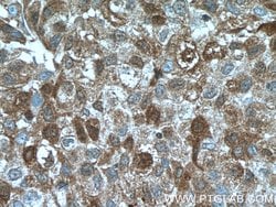 TNFAIP1 Mouse anti-Human, Clone: 4F11B5, Proteintech 150 &mu;L; Unconjugated:Antibodies,