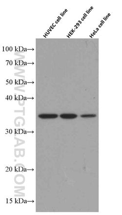 TNFAIP1 Mouse anti-Human, Clone: 4F11B5, Proteintech 150 &mu;L; Unconjugated:Antibodies,