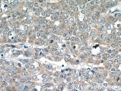TNFAIP1 Mouse anti-Human, Clone: 4F11B5, Proteintech 150 &mu;L; Unconjugated:Antibodies,
