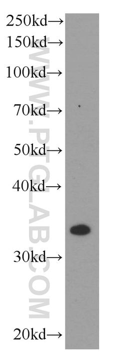 TNFAIP1 Mouse anti-Human, Clone: 4F11B5, Proteintech 150 &mu;L; Unconjugated:Antibodies,