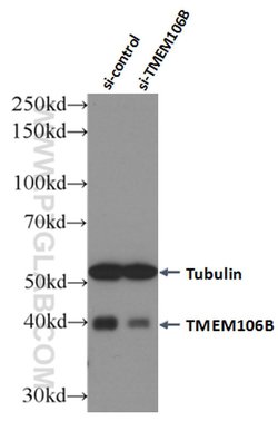 TMEM106B Mouse anti-Human, Clone: 5D1F8, Proteintech:Antibodies:Primary