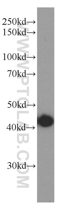 TMEM106B Mouse anti-Human, Clone: 5D1F8, Proteintech:Antibodies:Primary