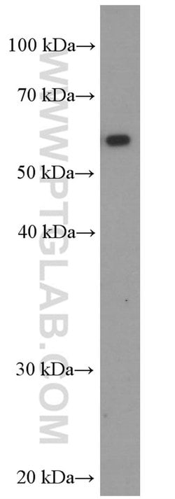 HEXA Mouse anti-Human, Clone: 3A4F2, Proteintech 150 &mu;L; Unconjugated:Antibodies,