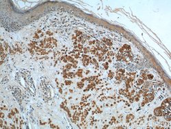 MLANA Mouse anti-Human, Clone: 4F10D6, Proteintech:Antibodies:Primary Antibodies