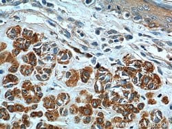 MLANA Mouse anti-Human, Clone: 4F10D6, Proteintech:Antibodies:Primary Antibodies