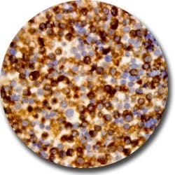 Acetyl-CoA Carboxylase (ACC) Monoclonal Antibody (143), Abbomax 100 &mu;g | Buy Online | Abbomax Inc | Fisher Scientific