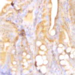 BAX Monoclonal Antibody (ZY455), Abbomax 100 &mu;g; Unconjugated:Antibodies,
