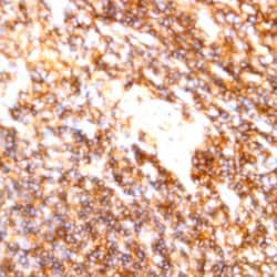 CD22 Monoclonal Antibody (RFB4), Abbomax 100 &mu;g | Buy Online | Abbomax Inc | Fisher Scientific
