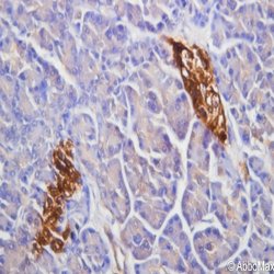 PAX6 Monoclonal Antibody (E5B), Abbomax 100 &mu;g; Unconjugated:Antibodies,