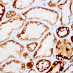 Cytokeratin 5 (CK5) Monoclonal Antibody (XM26), Abbomax 100 &mu;g; Unconjugated:Antibodies,