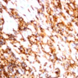 CD79b Monoclonal Antibody (SN8), Abbomax 100 &mu;g; Unconjugated:Antibodies,
