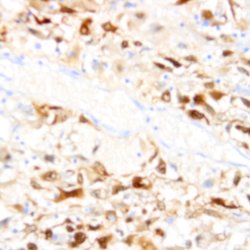 B7H4 (VTCN1) Monoclonal Antibody (ZY346), Abbomax 100 &mu;g; Unconjugated:Antibodies,