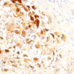 PD-L1 (CD274) Monoclonal Antibody (ZY349), Abbomax 100 &mu;g; Unconjugated:Antibodies,