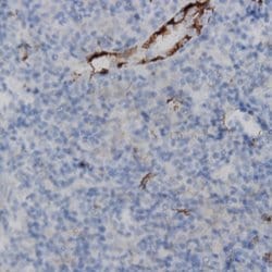 TTF1 (thyroid transcription factor 1) Monoclonal Antibody (SP141), Abbomax