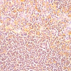 Il-10 Monoclonal Antibody (JES5-2A5), Abbomax 100 &mu;g; Unconjugated:Antibodies,