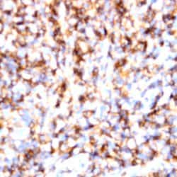 TCRa/b Monoclonal Antibody (IP26), Abbomax 100 &mu;g | Buy Online | Abbomax Inc | Fisher Scientific