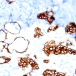 Cytokeratin (Pan) Monoclonal Antibody (PanCK-C11), Abbomax 100 &mu;g; Unconjugated:Antibodies,