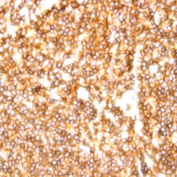 CD20 Monoclonal Antibody (13.6E12), Abbomax 100 &mu;g; Unconjugated:Antibodies,