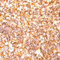 CD20 Monoclonal Antibody (2H7), Abbomax 100 &mu;g; Unconjugated:Antibodies,