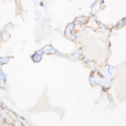 Nix Monoclonal Antibody (ZY163), Abbomax 100 &mu;g; Unconjugated:Antibodies,