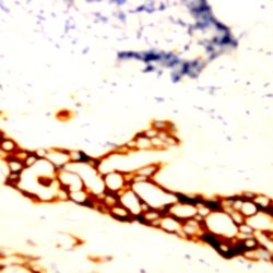 Cytokeratin 6 Monoclonal Antibody (LHK6), Abbomax 100 &mu;g; Unconjugated:Antibodies,
