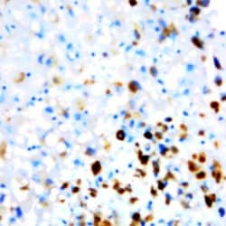 Digoxigenin Monoclonal Antibody (Dig), Abbomax 100 &mu;g; Unconjugated:Antibodies,