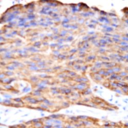 Epha 3 Monoclonal Antibody (5E11F2), Abbomax 100 &mu;g; Unconjugated:Antibodies,