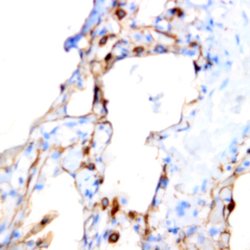 Podocalyxin/GCTM-1 Monoclonal Antibody (ZY165), Abbomax 100 &mu;g | Buy Online | Abbomax Inc | Fisher Scientific