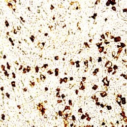 Human IgG1 Monoclonal Antibody (HP6069), Abbomax 100 &mu;g; Unconjugated:Antibodies,