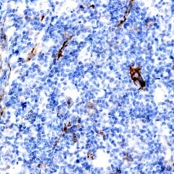 MUC1 (EMA) Monoclonal Antibody (E29), Abbomax 100 &mu;g | Buy Online | Abbomax Inc | Fisher Scientific
