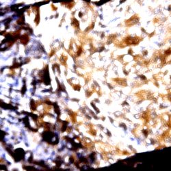MAdCAM1 Monoclonal Antibody (355G8), Abbomax 100 &mu;g; Unconjugated:Antibodies,