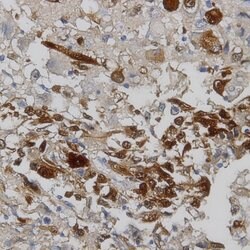 MAGE1 Monoclonal Antibody (MA454), Abbomax 100 &mu;g; Unconjugated:Antibodies,
