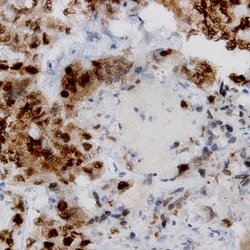 PCNA Monoclonal Antibody (PC10), Abbomax 100 &mu;g | Buy Online | Abbomax Inc | Fisher Scientific