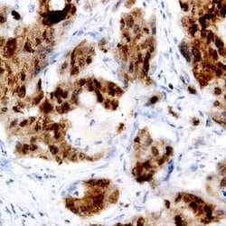 PCPTP1 Monoclonal Antibody (T10), Abbomax 100 &mu;g; Unconjugated:Antibodies,