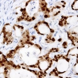PI3K p85 beta Monoclonal Antibody (T15), Abbomax 100 &mu;g; Unconjugated:Antibodies,