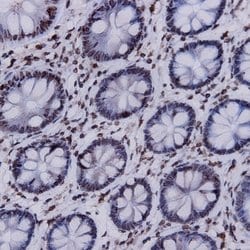 Renal Cell Carcinoma (RCC, gp200) Monoclonal Antibody (PN-15), Abbomax 100 &mu;g | Buy Online | Abbomax Inc | Fisher Scientific