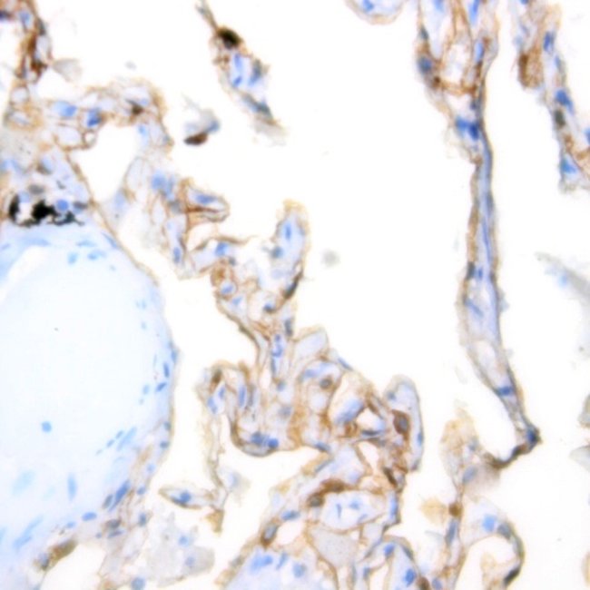 TRIM29 (Lung Squamous Cell Carcinoma Marker) Monoclonal Antibody